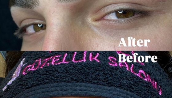 Foto Galeri – Hayel Güzellik Merkezi